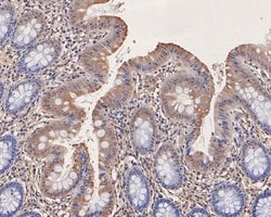 Invitrogen ATG14 Polyclonal Antibody 100 &mu;L; Unconjugated:Antibodies,