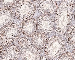 Invitrogen ATG14 Polyclonal Antibody 100 &mu;L; Unconjugated:Antibodies,