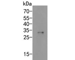 Invitrogen SCN1A Polyclonal Antibody 100 &mu;L; Unconjugated:Antibodies,