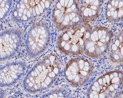Invitrogen CEACAM8 Polyclonal Antibody 100 μL; Unconjugated:Antibodies,