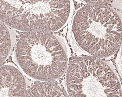Invitrogen PPP3CC Polyclonal Antibody 100 &mu;L; Unconjugated:Antibodies,