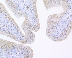Invitrogen UAP56 Polyclonal Antibody 100 &mu;L; Unconjugated:Antibodies,