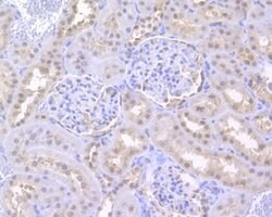 Invitrogen UAP56 Polyclonal Antibody 100 &mu;L; Unconjugated:Antibodies,