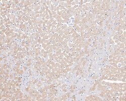 Invitrogen Phospholamban Polyclonal Antibody 100 &mu;L | Buy Online | Invitrogen&trade; | Fisher Scientific