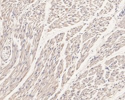 Invitrogen Phospholamban Polyclonal Antibody 100 &mu;L | Buy Online | Invitrogen&trade; | Fisher Scientific