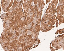 Invitrogen Phospholamban Polyclonal Antibody 100 &mu;L | Buy Online | Invitrogen&trade; | Fisher Scientific