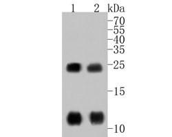Invitrogen Phospholamban Polyclonal Antibody 100 &mu;L | Buy Online | Invitrogen&trade; | Fisher Scientific