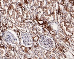 Invitrogen TRAP alpha Polyclonal Antibody 100 &mu;L | Buy Online | Invitrogen&trade; | Fisher Scientific