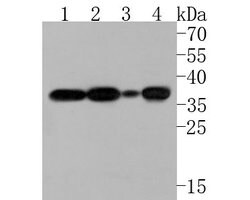 Invitrogen TRAP alpha Polyclonal Antibody 100 &mu;L | Buy Online | Invitrogen&trade; | Fisher Scientific