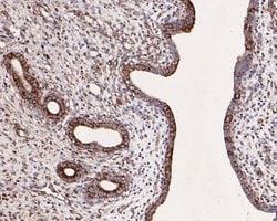 Invitrogen SNX9 Polyclonal Antibody 100 μL; Unconjugated:Antibodies,