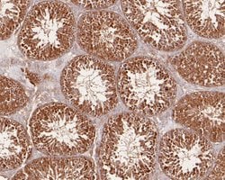Invitrogen SNX9 Polyclonal Antibody 100 μL; Unconjugated:Antibodies,