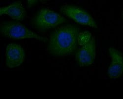 Invitrogen JNK2 Polyclonal Antibody 100 &mu;L; Unconjugated:Antibodies,