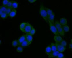 Invitrogen JNK2 Polyclonal Antibody 100 &mu;L; Unconjugated:Antibodies,