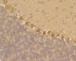 Invitrogen JNK2 Polyclonal Antibody 100 &mu;L; Unconjugated:Antibodies,