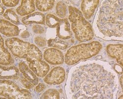 Invitrogen JNK2 Polyclonal Antibody 100 &mu;L; Unconjugated:Antibodies,