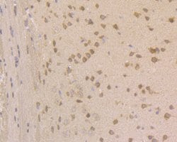 Invitrogen JNK2 Polyclonal Antibody 100 &mu;L; Unconjugated:Antibodies,