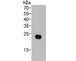 Invitrogen AP repeat Polyclonal Antibody 100 &mu;L; Unconjugated:Antibodies,