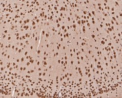 TCF21 Polyclonal Antibody, Invitrogen 100 &mu;L; Unconjugated:Antibodies,