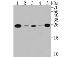 TCF21 Polyclonal Antibody, Invitrogen 100 &mu;L; Unconjugated:Antibodies,