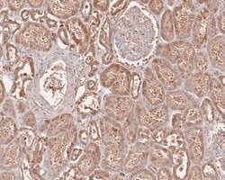 Invitrogen Phospho-AKT2 (Ser474) Polyclonal Antibody 100 μL; Unconjugated:Antibodies,