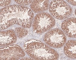 Invitrogen Phospho-AKT2 (Ser474) Polyclonal Antibody 100 μL; Unconjugated:Antibodies,