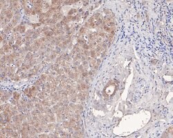 Invitrogen MCRS1 Polyclonal Antibody 100 &mu;L; Unconjugated:Antibodies,