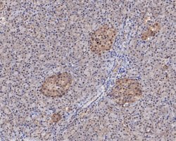 Invitrogen MCRS1 Polyclonal Antibody 100 &mu;L; Unconjugated:Antibodies,