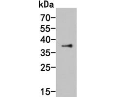 Invitrogen Histone Deacetylase Polyclonal Antibody 100 &mu;L | Buy Online | Invitrogen&trade; | Fisher Scientific