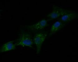Invitrogen PAI1 Polyclonal Antibody 100 &mu;L; Unconjugated:Antibodies,