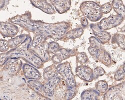 Invitrogen PAI1 Polyclonal Antibody 100 &mu;L; Unconjugated:Antibodies,