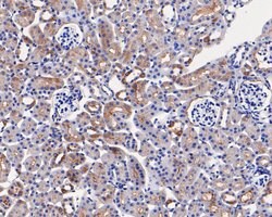 Invitrogen PAI1 Polyclonal Antibody 100 &mu;L; Unconjugated:Antibodies,