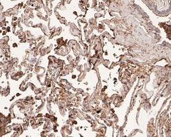 Invitrogen Aquaporin 4 Polyclonal Antibody 100 &mu;L; Unconjugated:Antibodies,