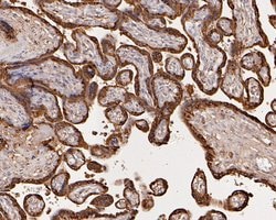 Invitrogen Placental lactogen Polyclonal Antibody 100 &mu;L; Unconjugated:Antibodies,