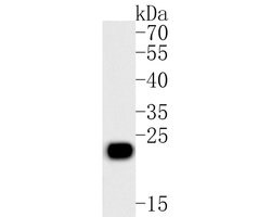 Invitrogen Placental lactogen Polyclonal Antibody 100 &mu;L; Unconjugated:Antibodies,