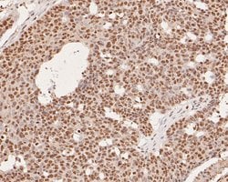 Invitrogen THOC5 Polyclonal Antibody 100 &mu;L; Unconjugated:Antibodies,