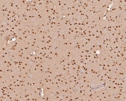 Invitrogen THOC5 Polyclonal Antibody 100 &mu;L; Unconjugated:Antibodies,