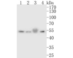 Invitrogen ONECUT3 Polyclonal Antibody 100 &mu;L; Unconjugated:Antibodies,