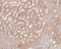 Invitrogen beta Galactosidase Polyclonal Antibody 100 &mu;L; Unconjugated:Antibodies,