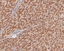 Invitrogen beta Galactosidase Polyclonal Antibody 100 &mu;L; Unconjugated:Antibodies,