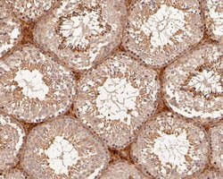 Invitrogen beta Galactosidase Polyclonal Antibody 100 &mu;L; Unconjugated:Antibodies,