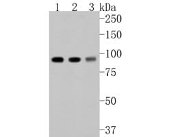 Invitrogen beta Galactosidase Polyclonal Antibody 100 &mu;L; Unconjugated:Antibodies,