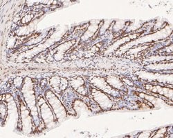 Invitrogen XPA Polyclonal Antibody 100 μL; Unconjugated:Antibodies,