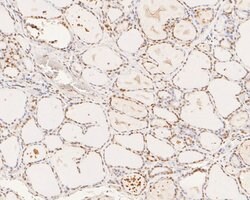 Invitrogen XPA Polyclonal Antibody 100 μL; Unconjugated:Antibodies,