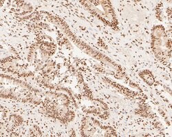 Invitrogen XPA Polyclonal Antibody 100 μL; Unconjugated:Antibodies,