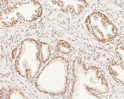 Invitrogen XPA Polyclonal Antibody 100 μL; Unconjugated:Antibodies,
