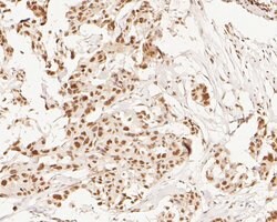 Invitrogen XPA Polyclonal Antibody 100 μL; Unconjugated:Antibodies,