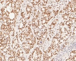 Invitrogen XPA Polyclonal Antibody 100 μL; Unconjugated:Antibodies,