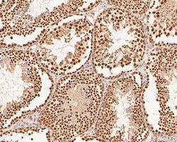 Invitrogen XPA Polyclonal Antibody 100 μL; Unconjugated:Antibodies,