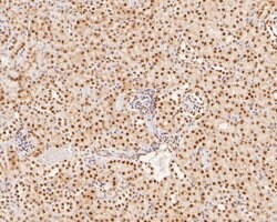 Invitrogen XPA Polyclonal Antibody 100 μL; Unconjugated:Antibodies,