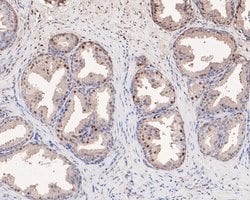 Invitrogen PP1 gamma Polyclonal Antibody 100 &mu;L; Unconjugated:Antibodies,